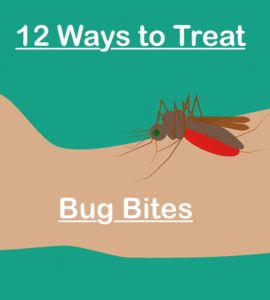 how to treat bug bites