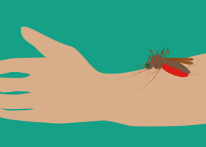 how to treat mosquito bites